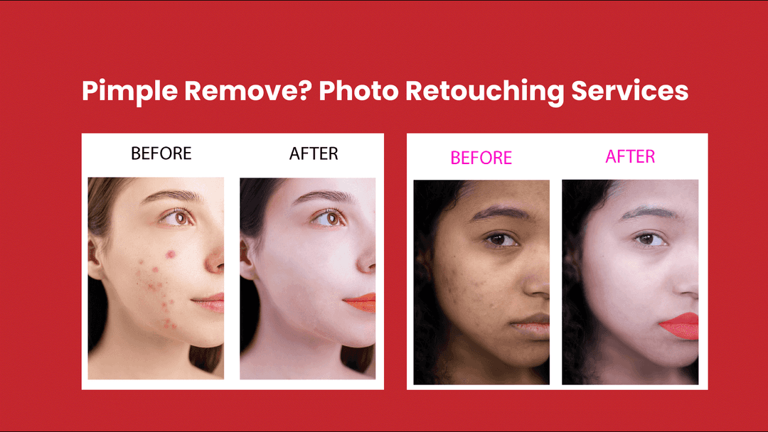 Professional Pimple Remove Dark Spot Remove Photo Retouching Services